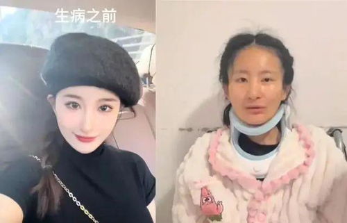 蔡磊回应26岁渐冻症女孩离世 蔡磊回应26岁渐冻症女孩离世