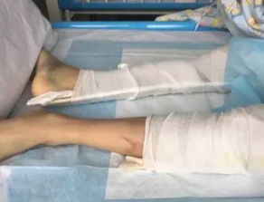 孕妇羊水破裂13岁男孩成功助产 孕妇羊水破裂13岁男孩成功助产