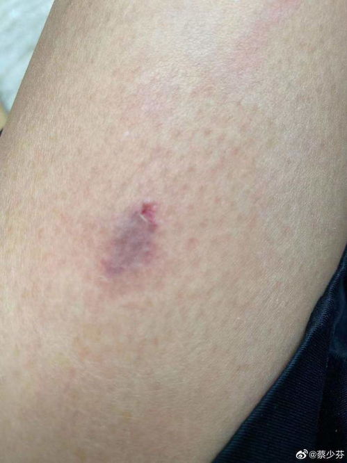 孕妇被狗咬 主人称狗咬的让狗道歉 孕妇被狗咬 主人称狗咬的让狗道歉
