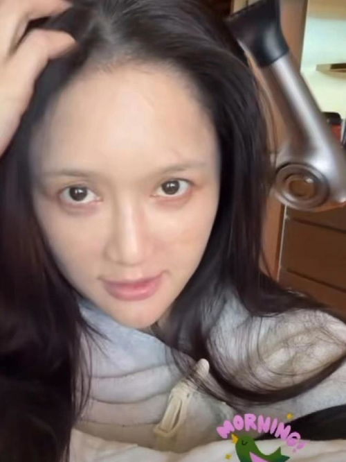 陈乔恩\满脸扎针\晒保养方法引热议(陈乔恩满脸扎针晒保养方法引热议) 陈乔恩\满脸扎针\晒保养方法引热议(陈乔恩满脸扎针晒保养方法引热议)