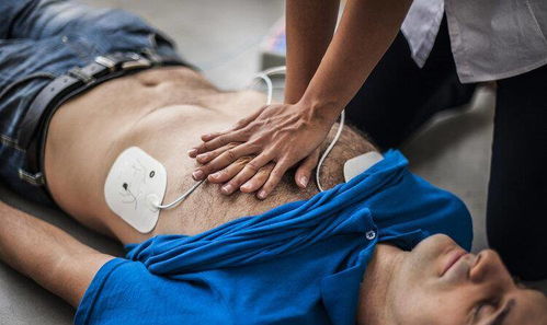 目击者回应男子心肺复苏被指袭胸(目击者视角下的男子心肺复苏事件,关于被指袭胸的真相探讨) 目击者回应男子心肺复苏被指袭胸(目击者视角下的男子心肺复苏事件,关于被指袭胸的真相探讨)