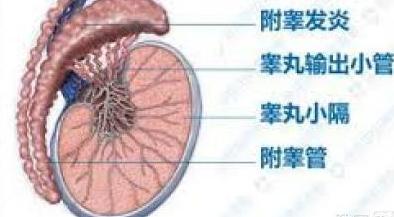 中山男子取结石冲出肝吸虫 中山男子取结石冲出肝吸虫