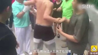 老人制止施暴鼻子被咬掉 伤情披露 老人制止施暴鼻子被咬掉 伤情披露